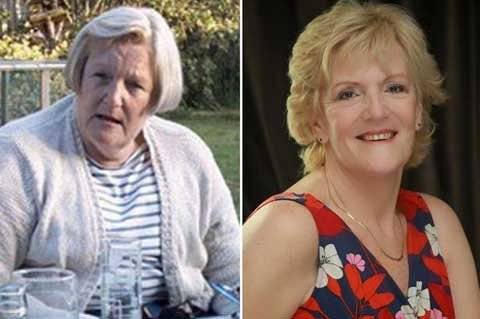 Xem bà già trẻ lại 15 tuổi nhờ thẩm mỹ