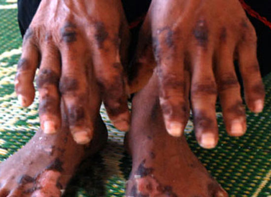 Choáng những căn 'bệnh lạ' chỉ có ở Việt Nam