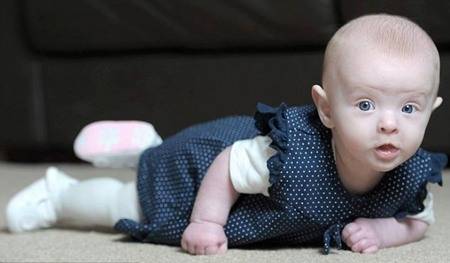 Bé gái ‘không có máu’ vẫn sống khỏe mạnh