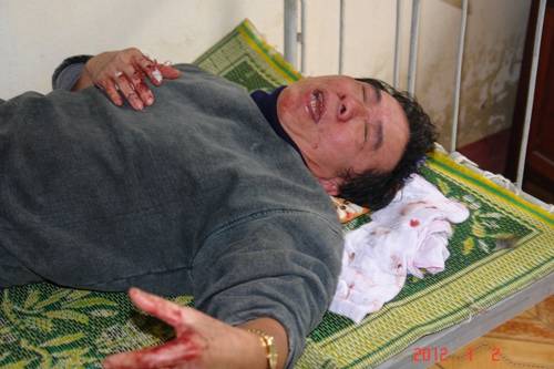 TBT báo Việt Nam EU PORA bị một giám đốc đánh chấn thương nặng