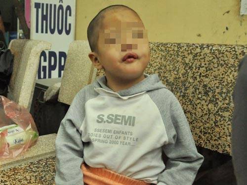 Bé gái 5 tuổi bị xâm hại tình dục ảnh hưởng thần kinh nặng nề