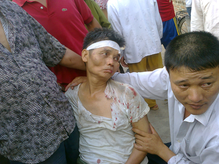 Hàng chục côn đồ truy đuổi, hành hung nông dân ở Văn Giang