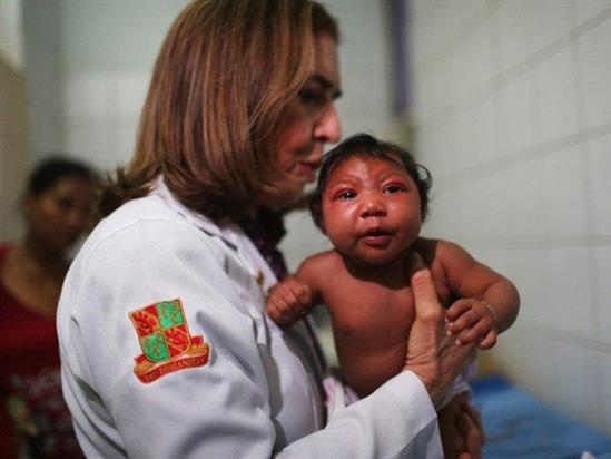 Thủ phạm gây teo não trẻ em không phải virus Zika?