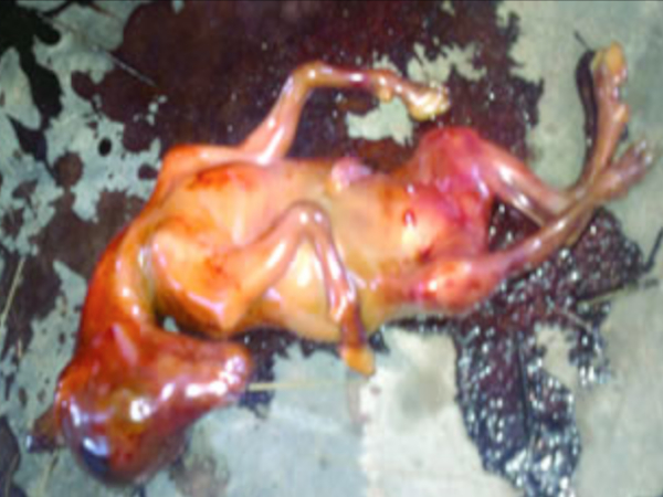 Kinh hoàng người phụ nữ đẻ ra... 