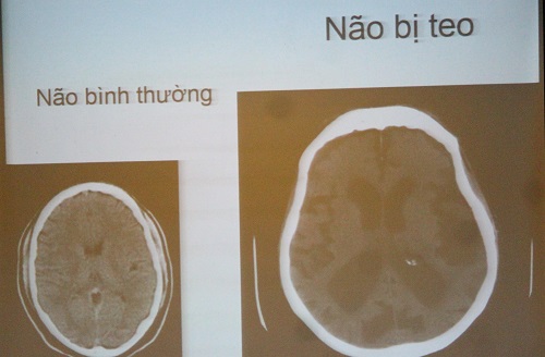 Hãy cho đấng mày râu xem hình ảnh dưới đây, họ đang say chén rượu sẽ phải đặt xuống ngay