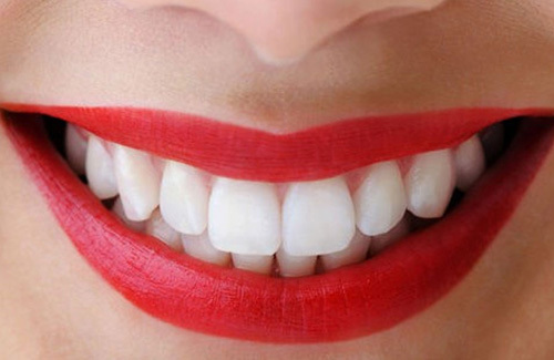 Tẩy trắng răng và những nguyên nhân làm thay đổi màu răng