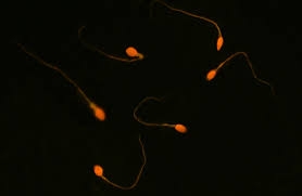 Nga phát triển phương pháp mới điều trị chứng vô sinh nam