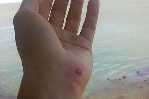 Sau Pique, đến lượt Shakira gặp nạn