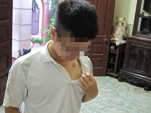 Chàng trai bị tố đánh mẹ: