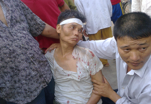 Vụ côn đồ hành hung ở Văn Giang: Khởi tố thêm 2 người