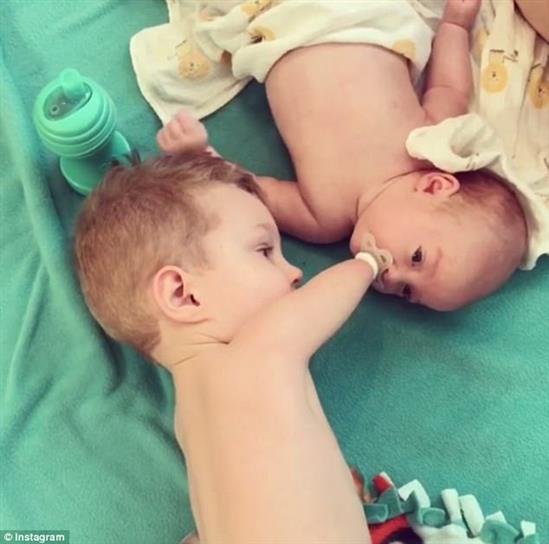 Khoảnh khắc xúc động khi bé trai 3 tuổi không tay chân dỗ dành em trai sơ sinh với núm vú giả