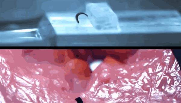 Mẫu robot siêu nhỏ có thể đưa vào cơ thể người để phân phát thuốc tới cơ quan bị bệnh