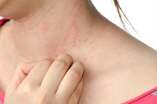 5 căn bệnh dễ 'tấn công' bạn khi thời tiết giao mùa