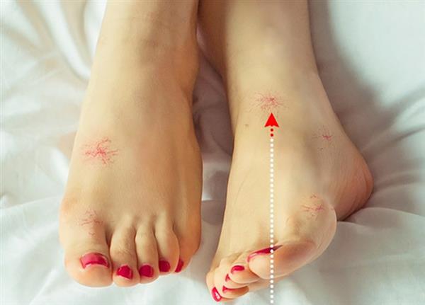 8 dấu hiệu ở chân cảnh báo bạn có thể đang mắc bệnh nguy hiểm