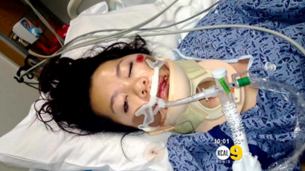 Một người gốc Việt bị cảnh sát Mỹ tấn công tình dục