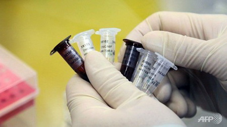 Vi khuẩn nguy hiểm thoát khỏi phòng thí nghiệm Mỹ