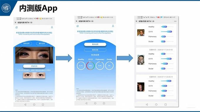 Trung Quốc phát triển công nghệ phát hiện nguy cơ mắc COVID-19 qua kiểm tra mắt