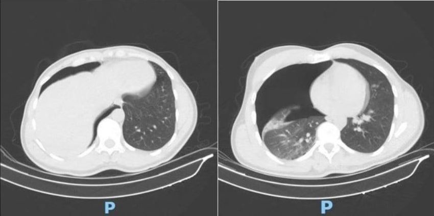 Xuyên đêm cứu du khách Nga gặp nạn nguy kịch tại TP.HCM