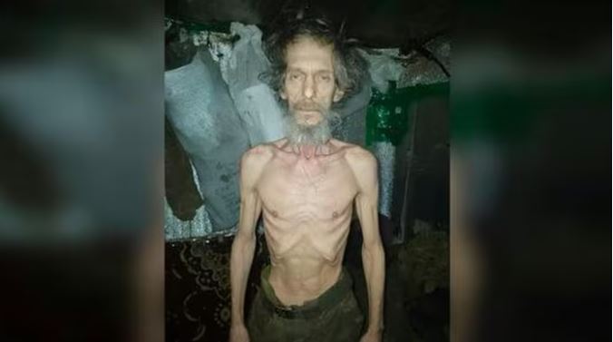 Hình ảnh binh sĩ suy kiệt phơi bày bê bối hậu cần trong quân đội Ukraine