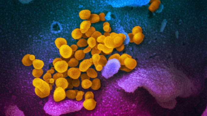 Các nhà khoa học khám phá ra nguồn gốc của coronavirus SARS-CoV-2