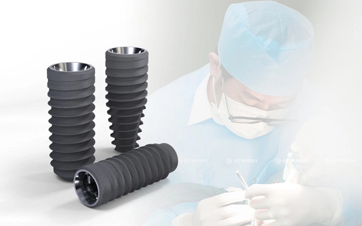Nha khoa thẩm mỹ Jet Dentist: Cấy ghép Implant Straumann