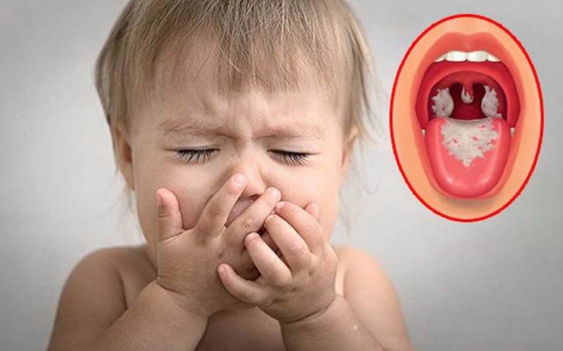 Tăng cường công tác phòng chống dịch bệnh bạch hầu