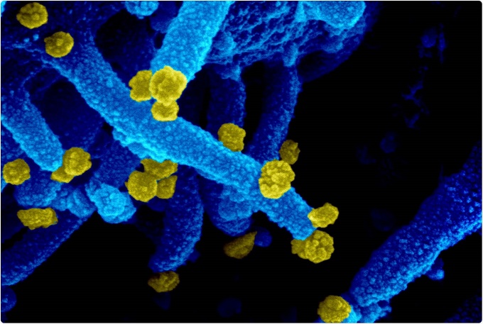 Biến thể 'kháng vaccine' Mu xuất hiện ở cả 50 tiểu bang Mỹ