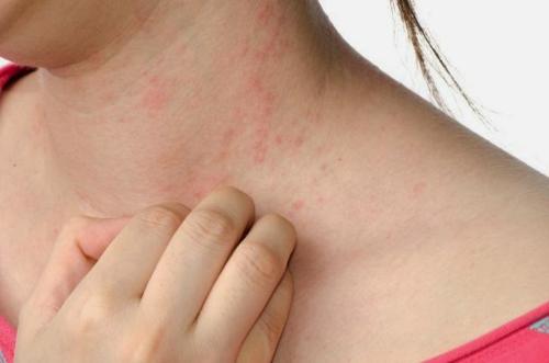 Cách giải độc gan hiệu quả mà không phải uống 1 viên thuốc nào