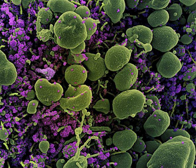 Nhật Bản phát hiện biến thể mới của virus SARS-CoV-2 khác với tại Anh và Nam Phi