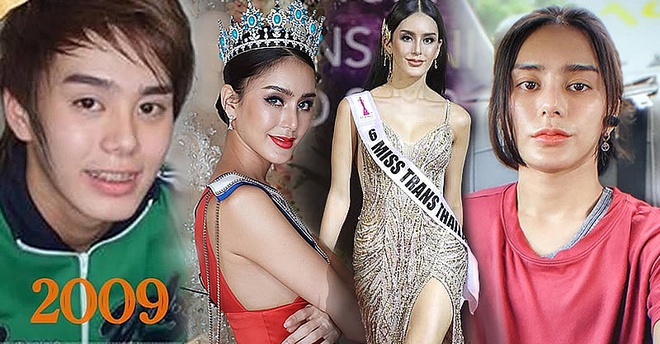 Hoa hậu chuyển giới Thái Lan phẫu thuật trở lại là nam giới