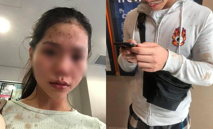 Cô gái gốc Việt và anh trai bị hất đồ uống, hành hung ở Úc vì đeo khẩu trang