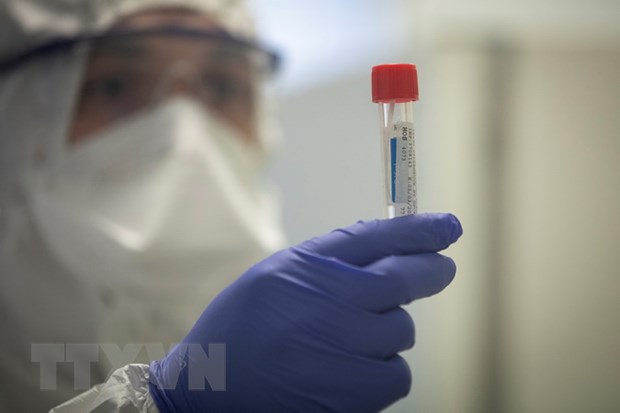 Nga cung cấp 800 bộ thử virus SARS-CoV-2 cho nhiều nước
