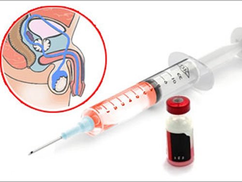 Luật sư đề nghị “thiến” hoá học tội phạm tình dục trẻ em