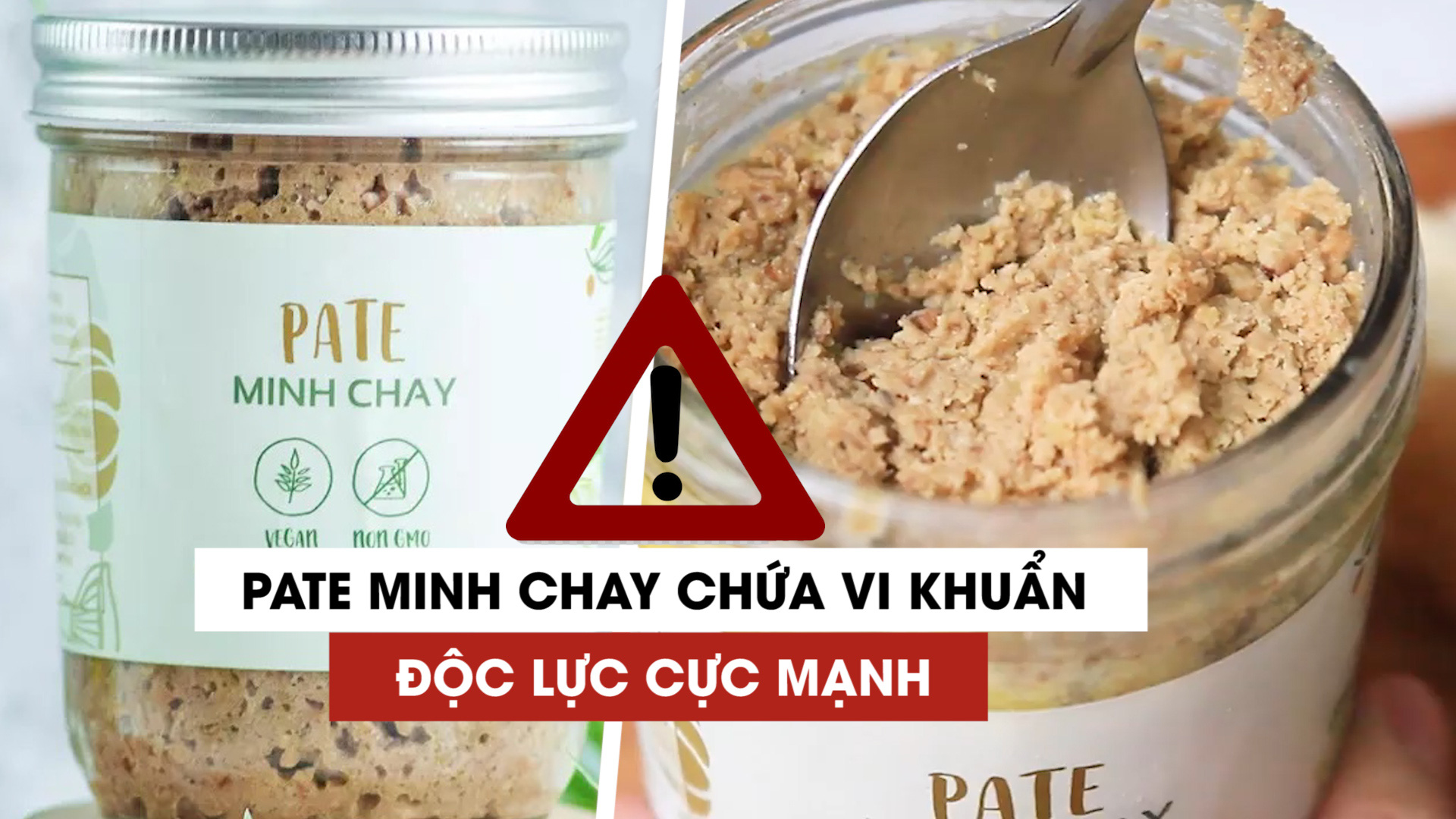 Tìm hiểu độc tố Botulinum nguy hiểm nhất thế giới có trong Pate Minh chay