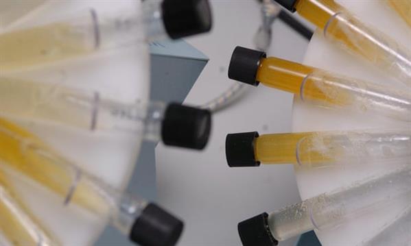 Xem xét khôi phục hoạt động Cơ quan Phòng chống Doping của Nga