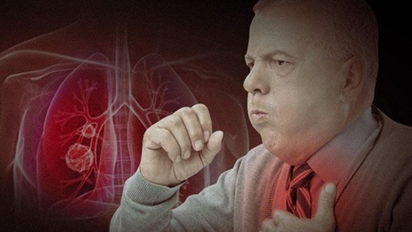 Chẩn đoán Covid-19 qua tiếng ho