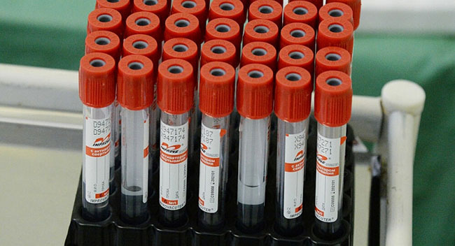 Chuyên gia Nga xóa tan quan niệm sai lầm về kháng thể đổi với virus SARS-CoV-2