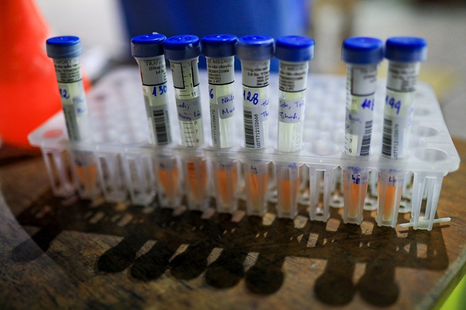 TP.HCM lấy gần 950.000 mẫu test nhanh, hơn 32.000 mẫu dương tính