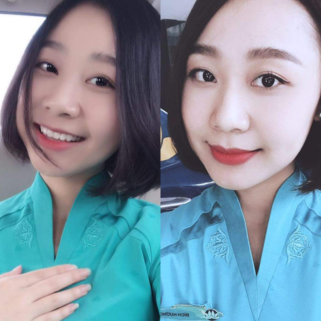 Nữ tiếp viên hàng không xinh đẹp bị Mercedes tông: Sợ phải ngồi xe lăn cả đời