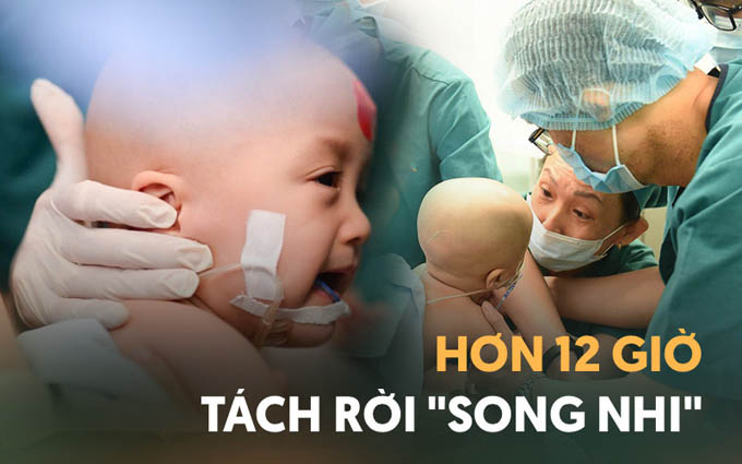 Khoảnh khắc xúc động trong suốt 12 tiếng phẫu thuật giúp Trúc Nhi - Diệu Nhi có được hình hài nguyên vẹn