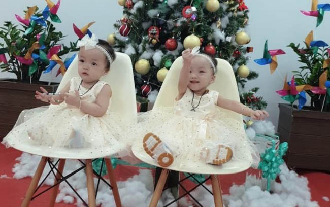 Cặp song sinh Trúc Nhi, Diệu Nhi sau 5 tháng phẫu thuật tách rời