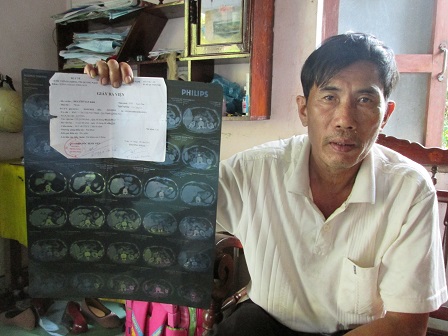 Kỳ diệu bài thuốc nam chữa khỏi ung thư gan
