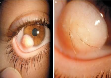 Những con mắt kinh dị 