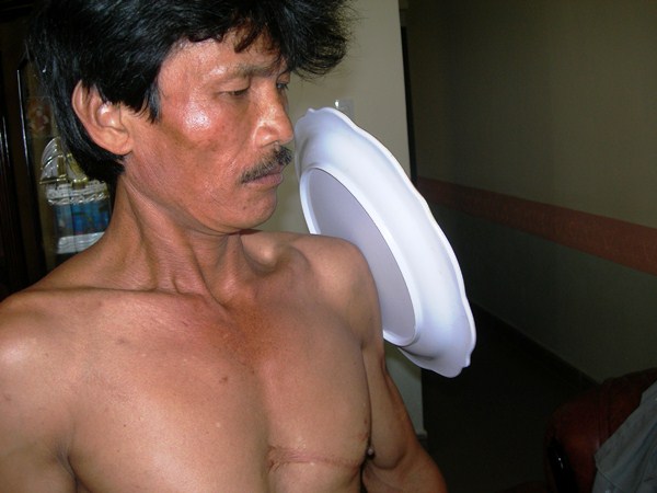 Người có khả năng siêu nhiên gây chấn động ở Lâm Đồng