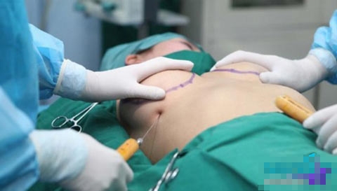 Choáng với thu nhập khủng của bác sĩ thẩm mỹ