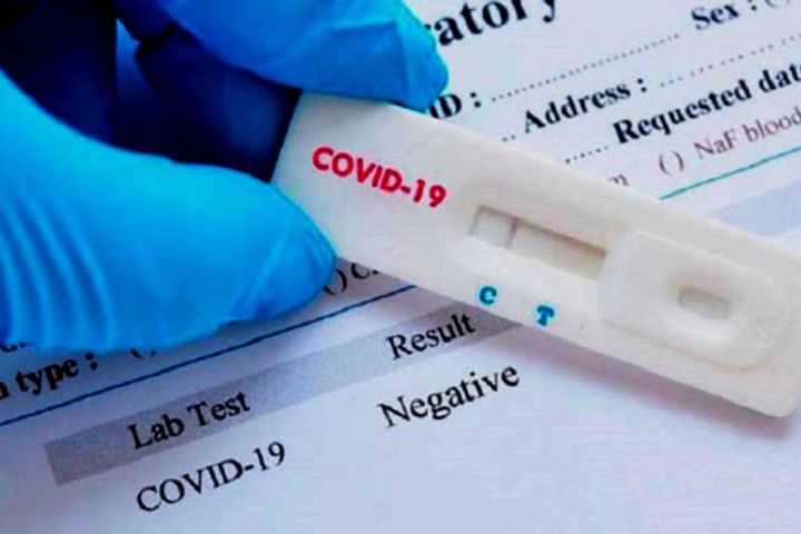 Doanh nghiệp đề xuất đàm phán trực tiếp mua test COVID-19 giá 1,5 USD