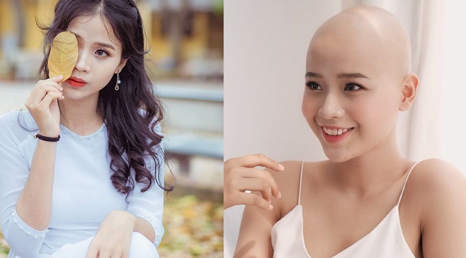 Vượt lên bệnh ung thư, nữ sinh tham dự cuộc thi nhan sắc!