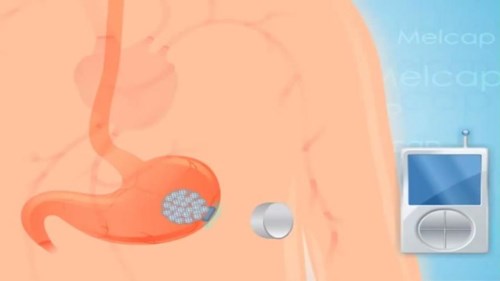 Viên thuốc kỳ diệu giúp chữa béo phì ra đời