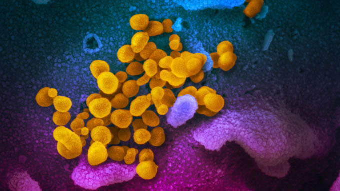 Nga sẵn sàng bắt đầu thử nghiệm kháng thể vô hiệu hóa coronavirus