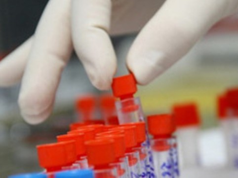 Sáng chế mới: Phát hiện sớm HIV chỉ sau 1 tuần phơi nhiễm